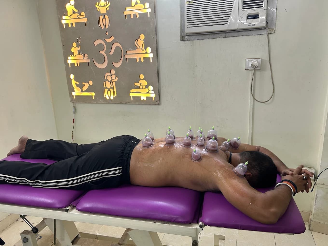 A patient receiving cupping therapy during a physiotherapy session